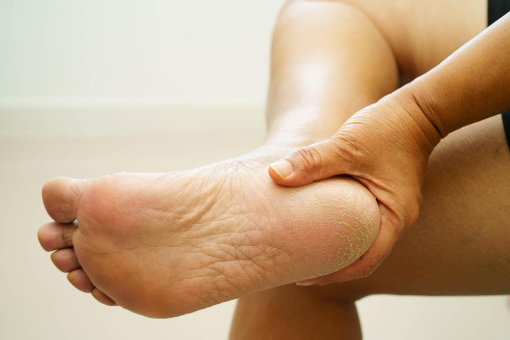 Diabetic Foot Care