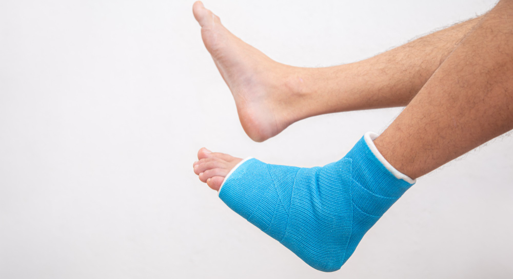 Foot Fractures